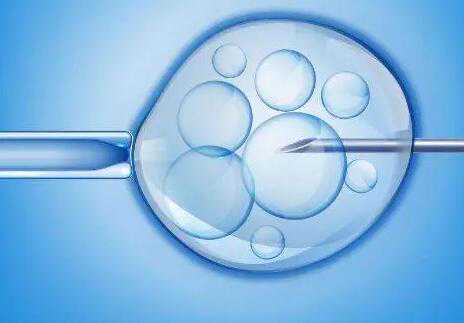 包成功苏州助孕 苏州大学附属第一医院做三代试管供卵生男孩费用明细 ‘孕囊